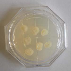 トリコスポロン属 (Trichosporon)